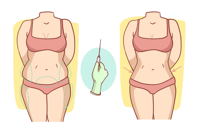 Liposuction Tucson