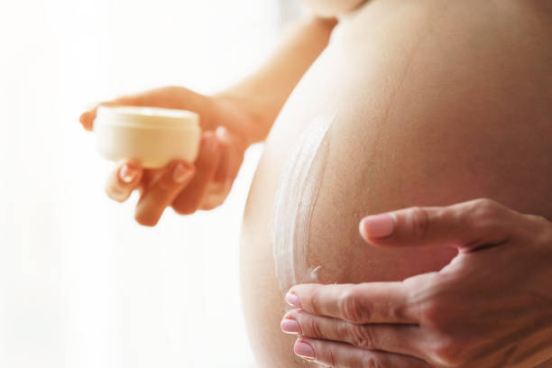 Stretch Marks cream