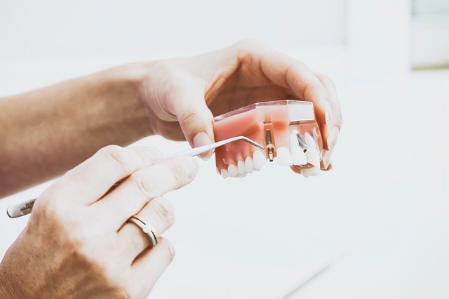 Emergency Dentist in Santa Rosa: Fast and Reliable Dental Care When You Need It Most